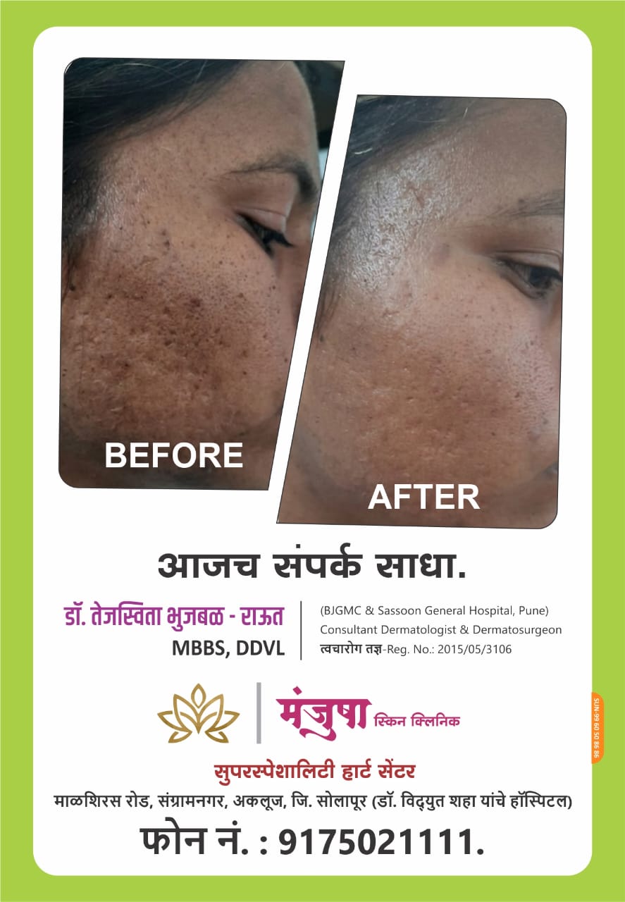 Patient Treatment Result 5