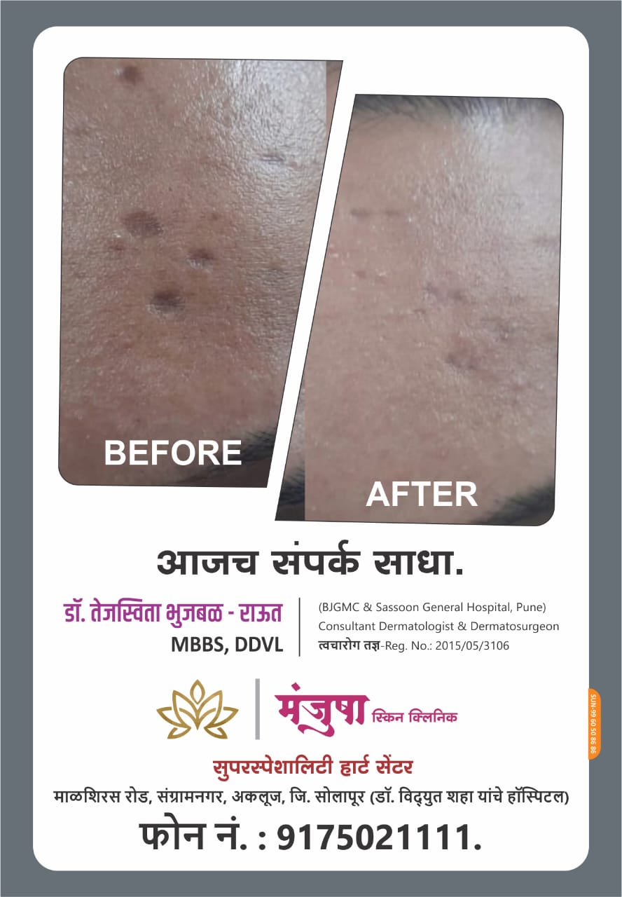 Patient Treatment Result 4