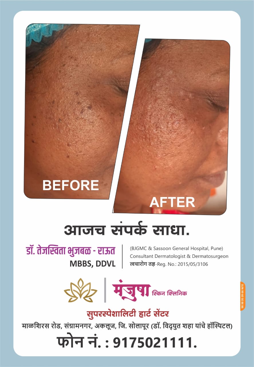 Patient Treatment Result 3