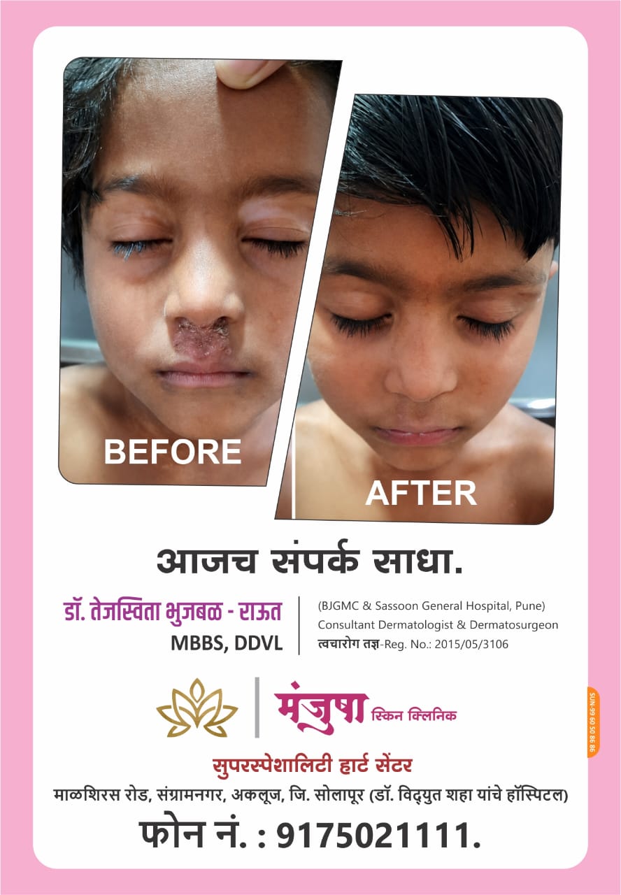 Patient Treatment Result 2